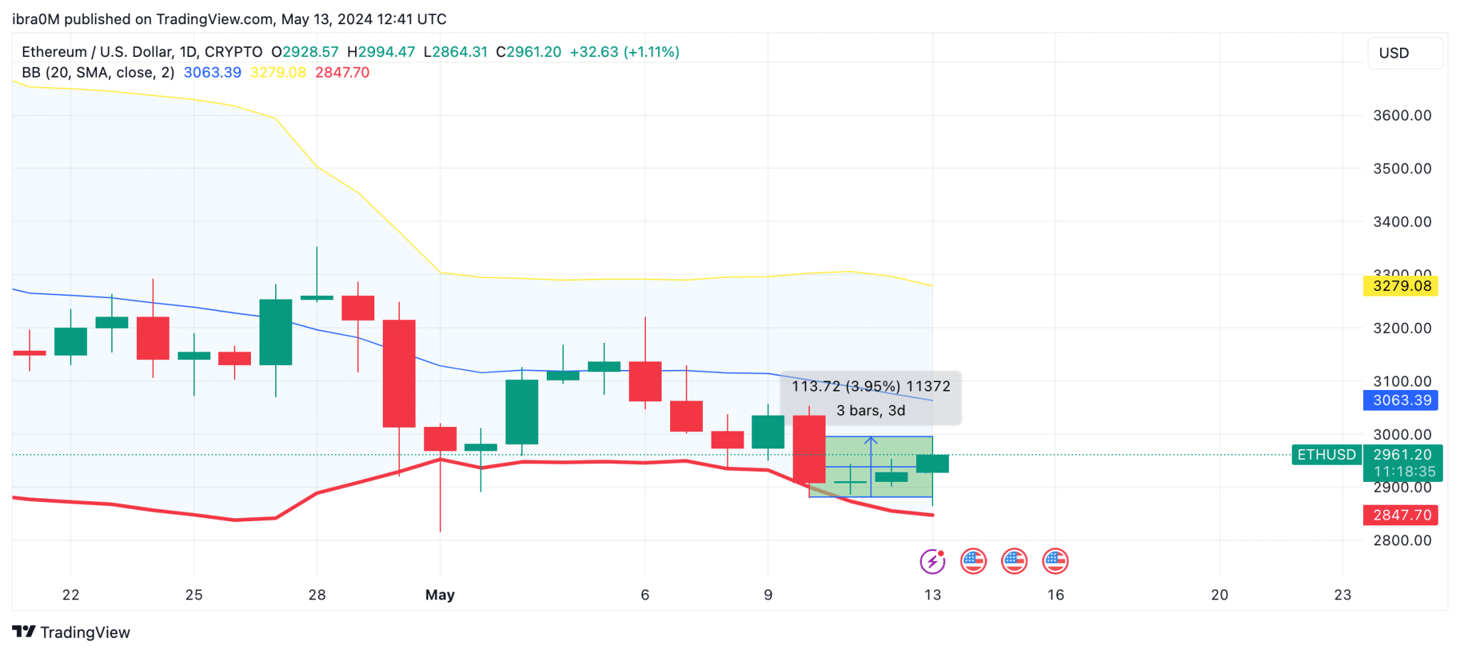 Ethereum ETH Price Prediction